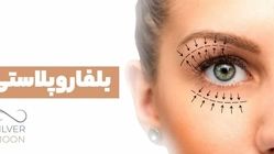 بلفاروپلاستی: راهنمای کامل جراحی پلک برای جوان‌سازی چشم‌ها