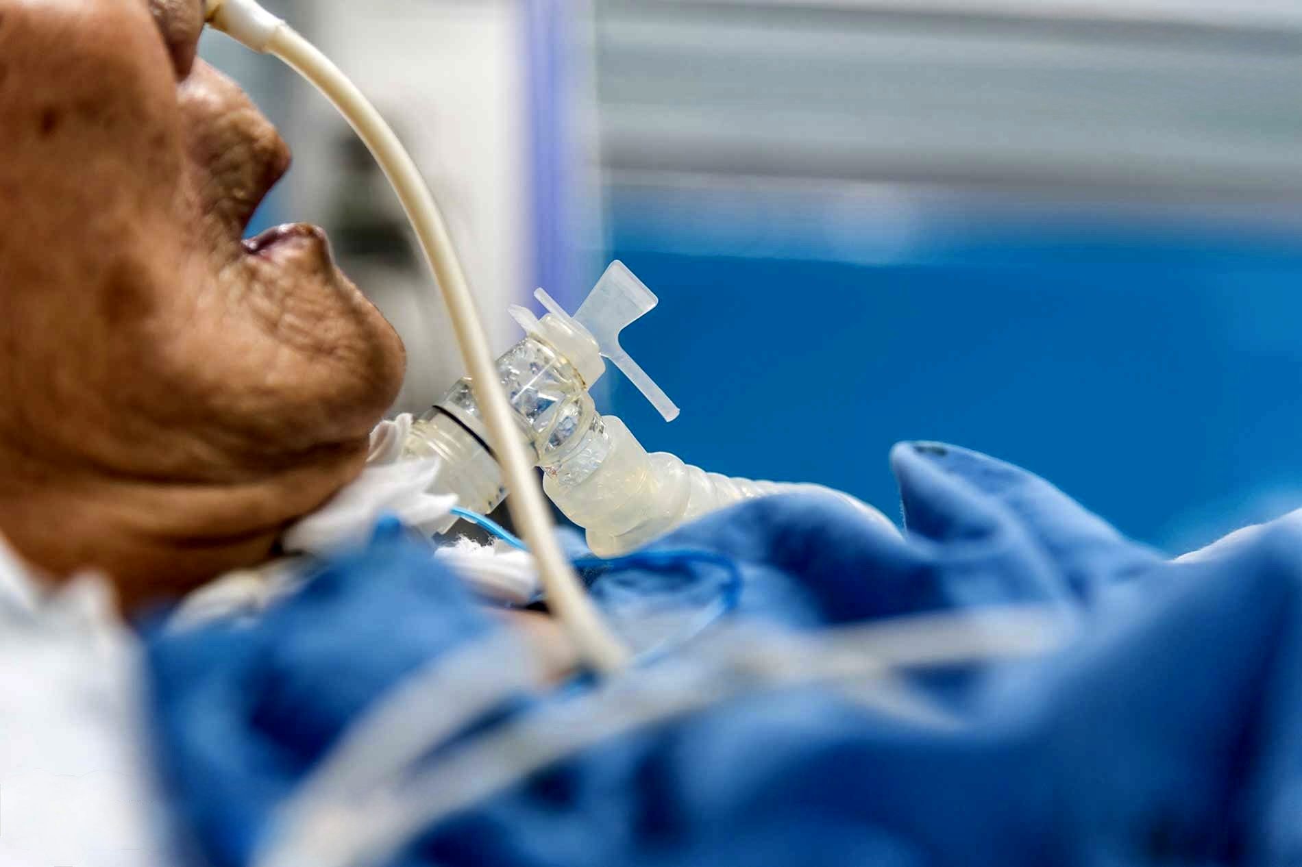 زدحام بیماران قلبی تنفسی در بیمارستان‌های خوزستان