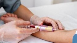 نمونه گیری در منزل تحت نظر بهترین آزمایشگاه تهران