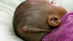 کودکان فلوجه: معمای پزشکی در قلب جنگ عراق