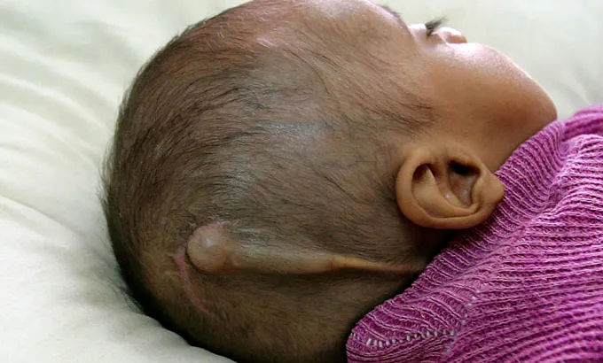 کودکان فلوجه: معمای پزشکی در قلب جنگ عراق