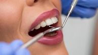 پر مصرف ترین مواد دندانپزشکی که باید بشناسید