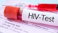 ۴۴ هزار نفر در ایران HIV مثبت هستند